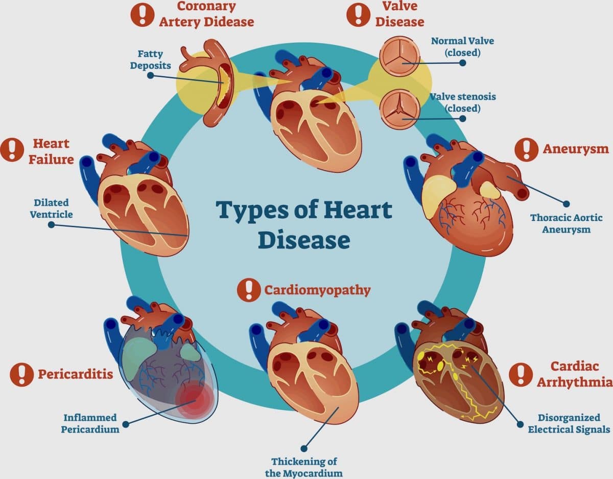 disease heart of test Getting Disease Through the of Heart to Cardiovascular disease heart of test Getting Disease Through the of Heart to Cardiovascular